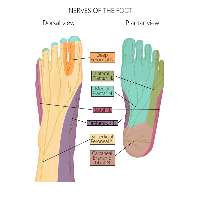 Common Peroneal Neuropathy